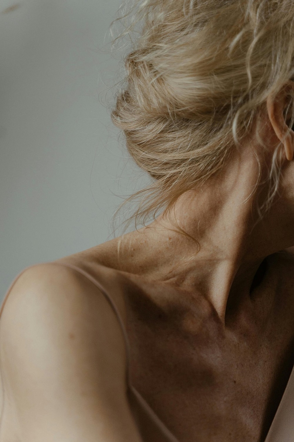 Are Neck Lifts Worth the Money?