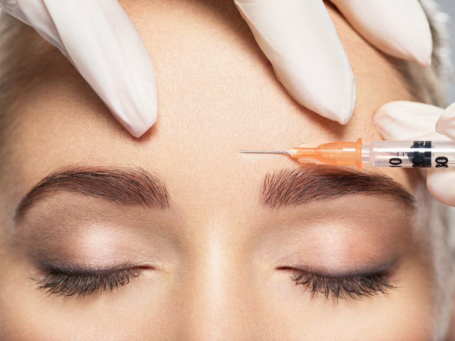 Injecting cosmetic treatment into forehead area.
