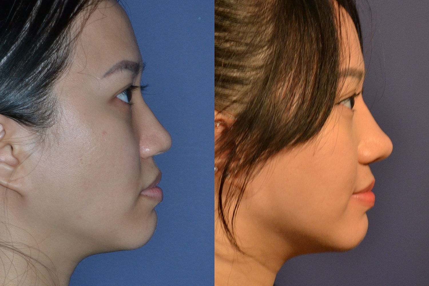 Before and after profile photo comparison.