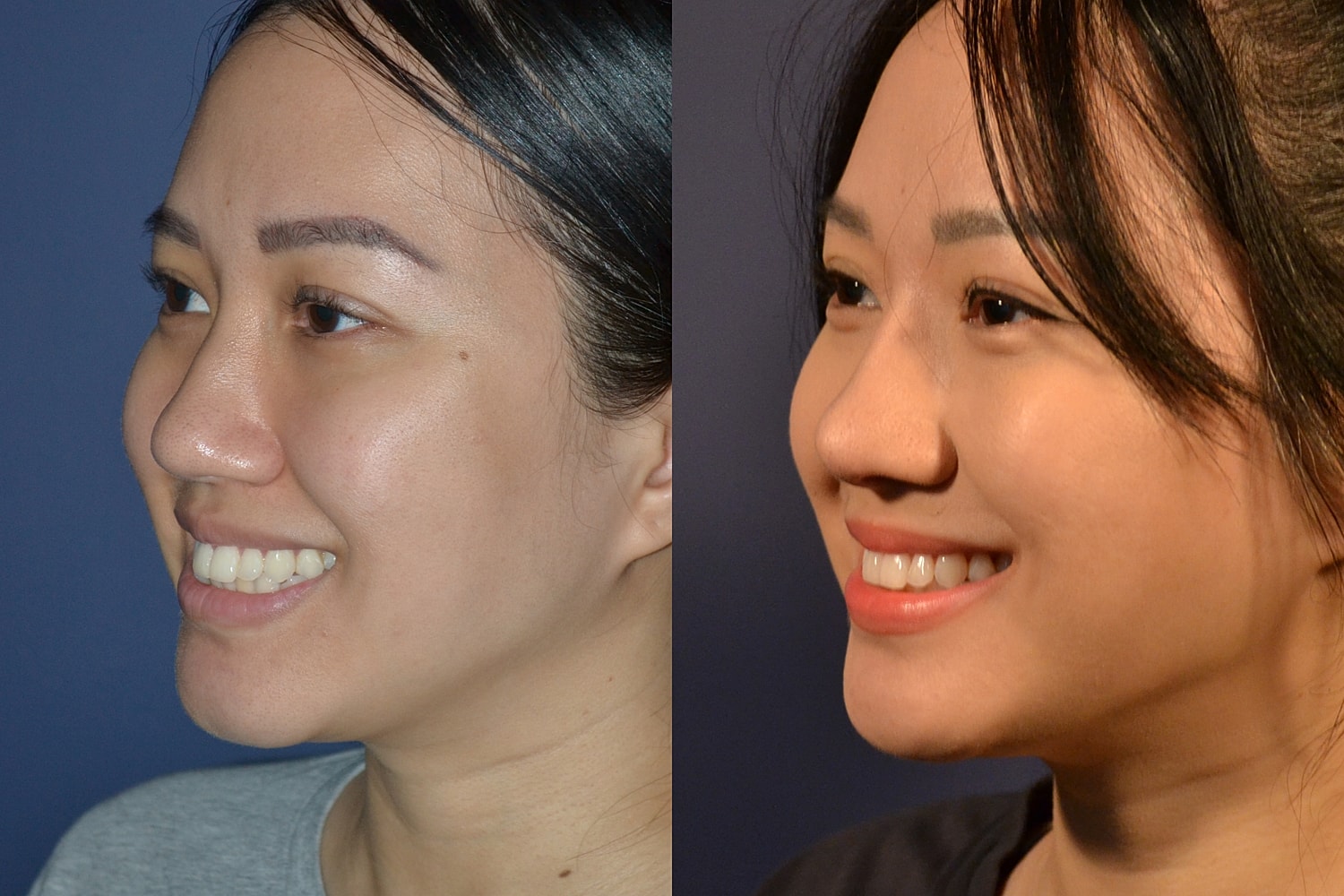 Two profile shots of a smiling woman.