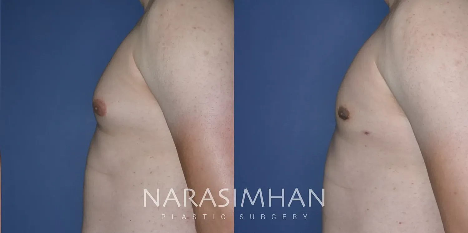 Body Contouring Before & After