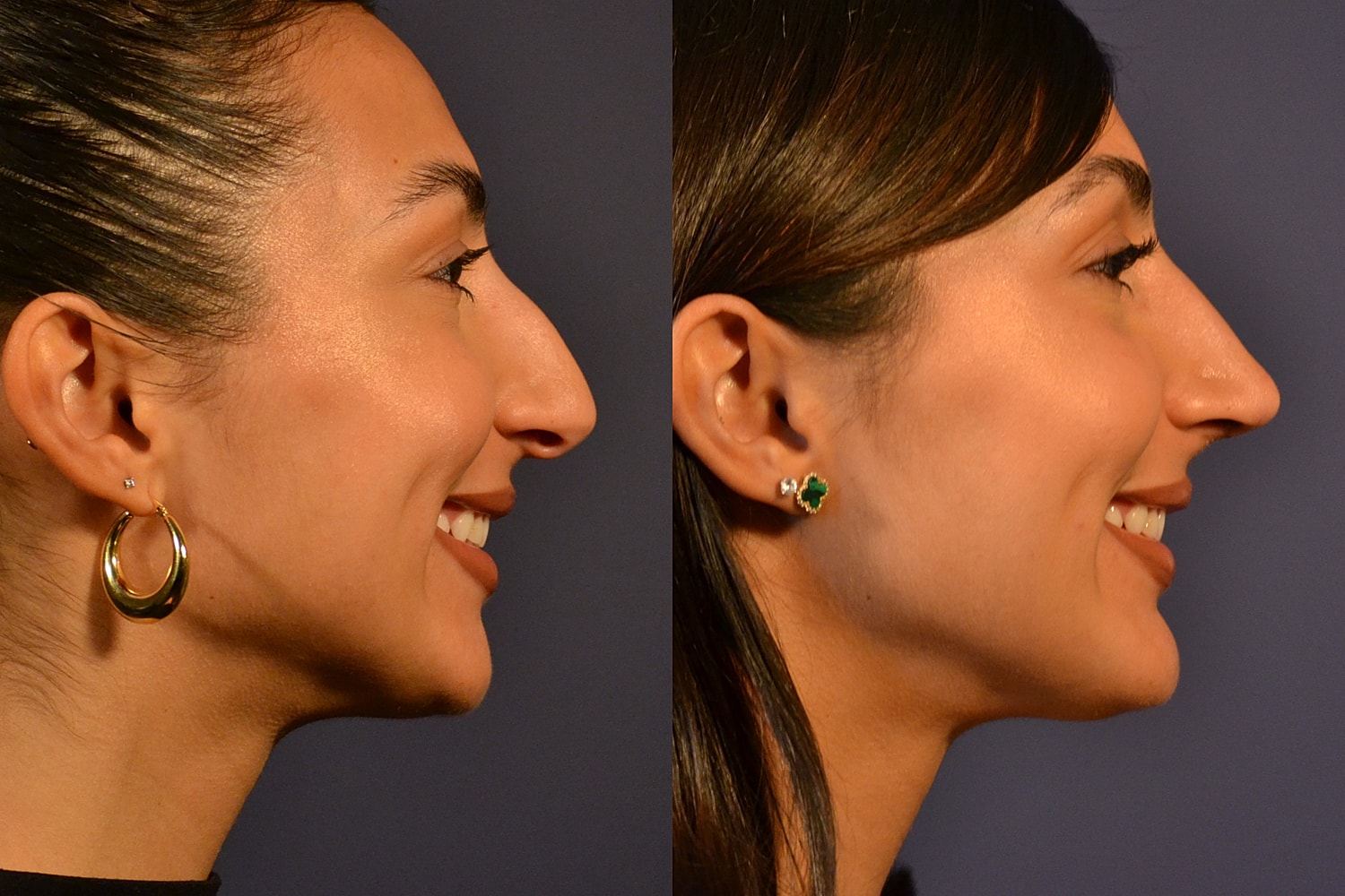 Profile images showcasing different earring styles.