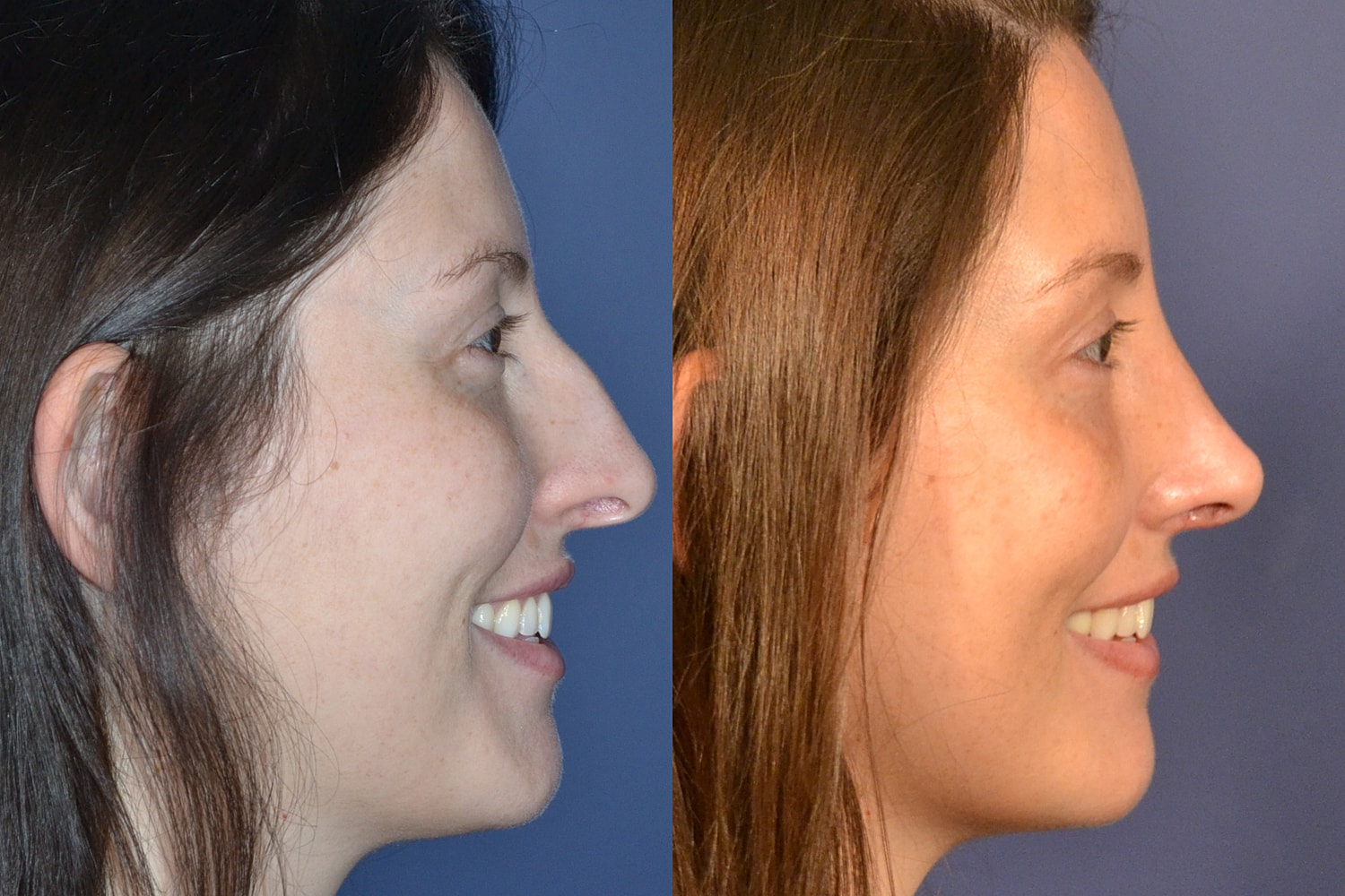 Profile comparison of a woman's appearance.