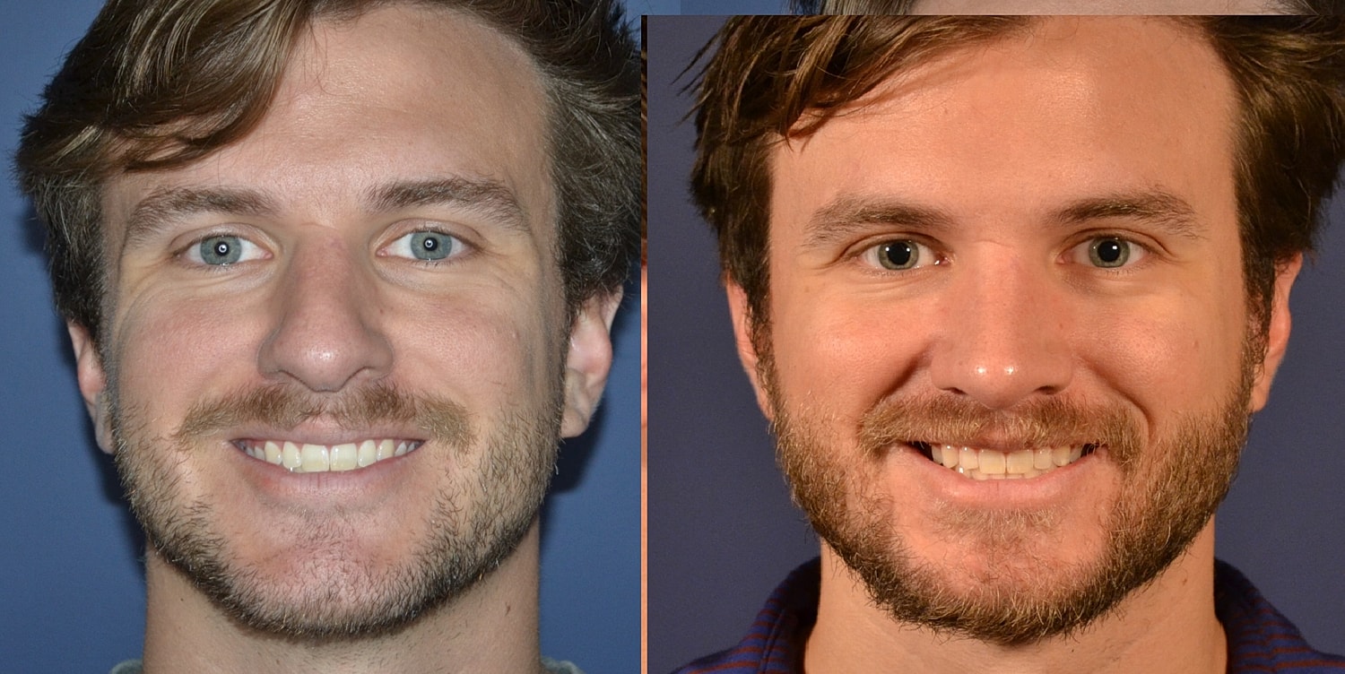 Two smiling men with different hairstyles and beards.