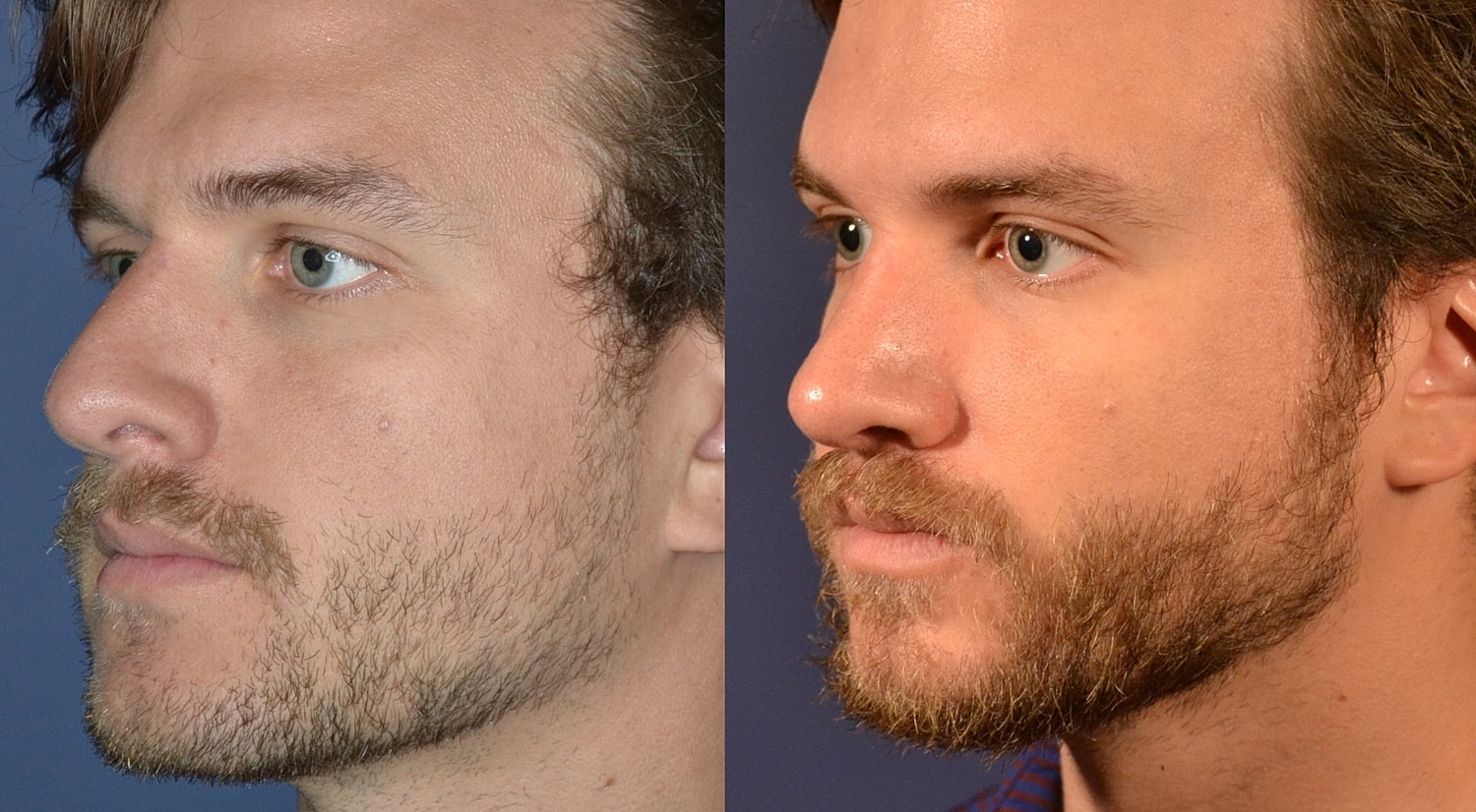 Side profiles of two bearded men.
