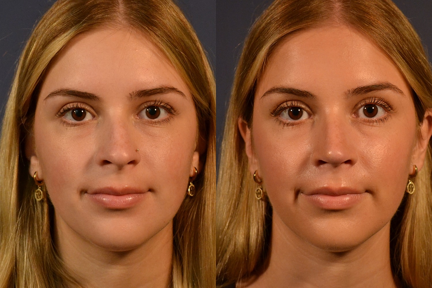 Comparison of two similar facial appearances.