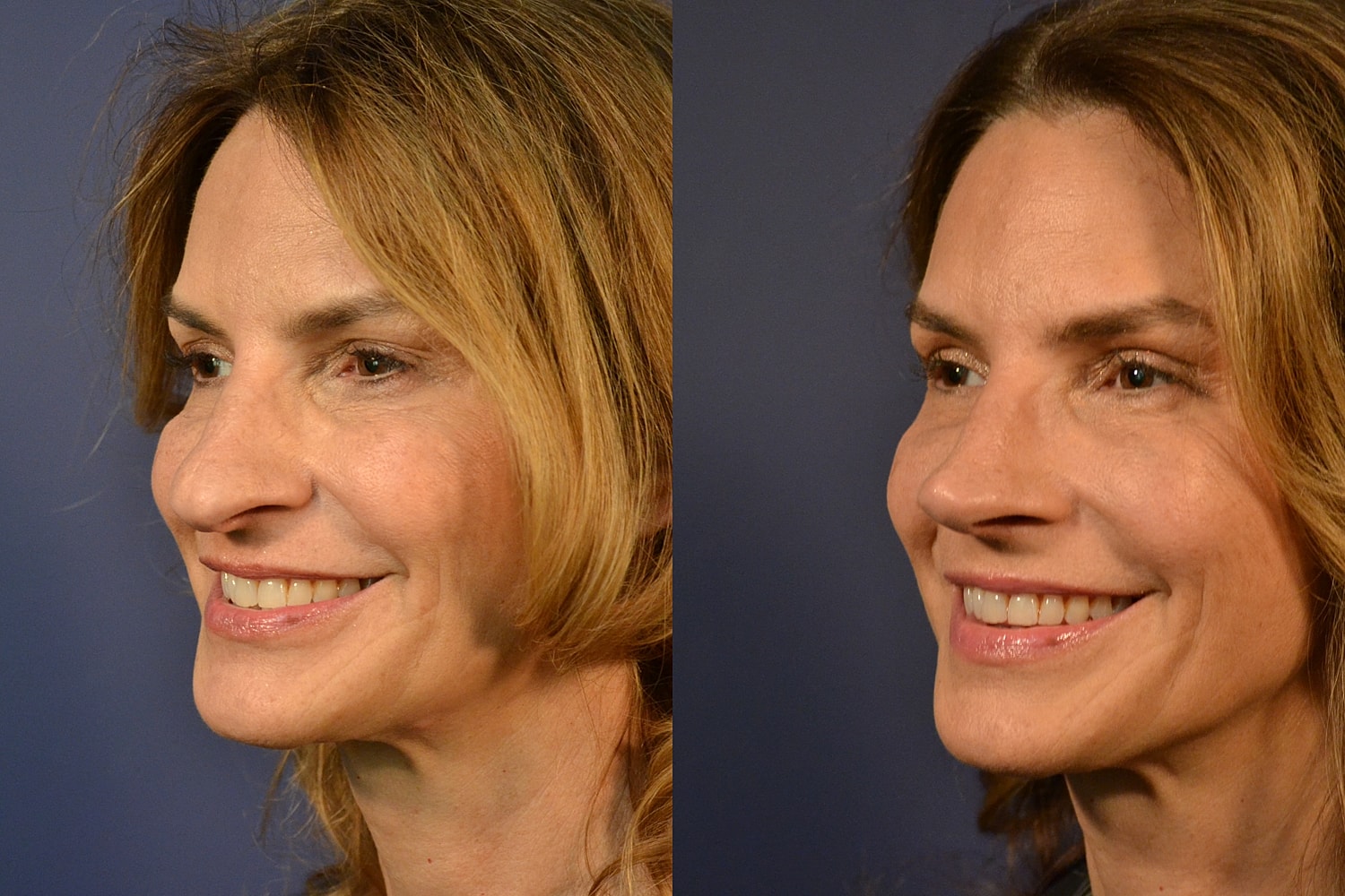 Two profile photos of a smiling woman.