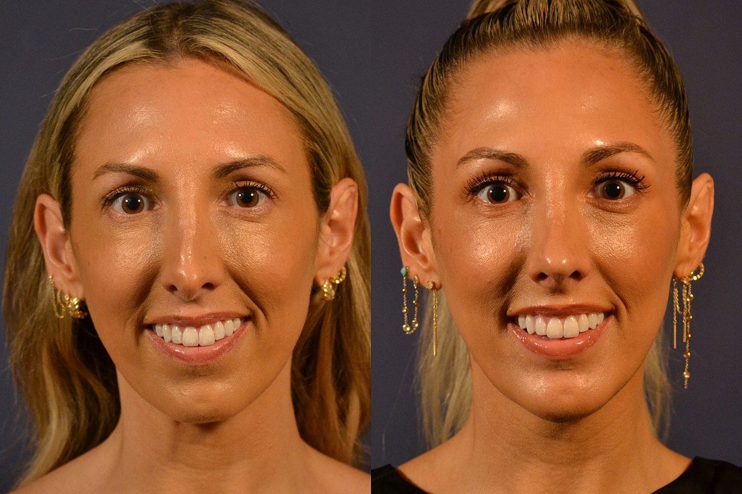 Side-by-side portraits of a woman smiling.