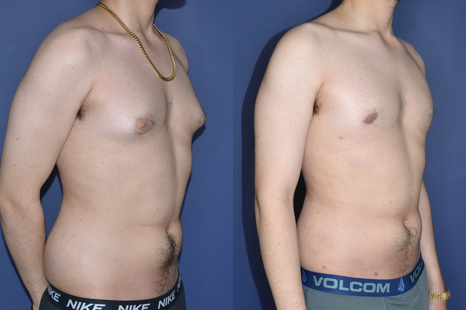 Before and after body transformation comparison image.