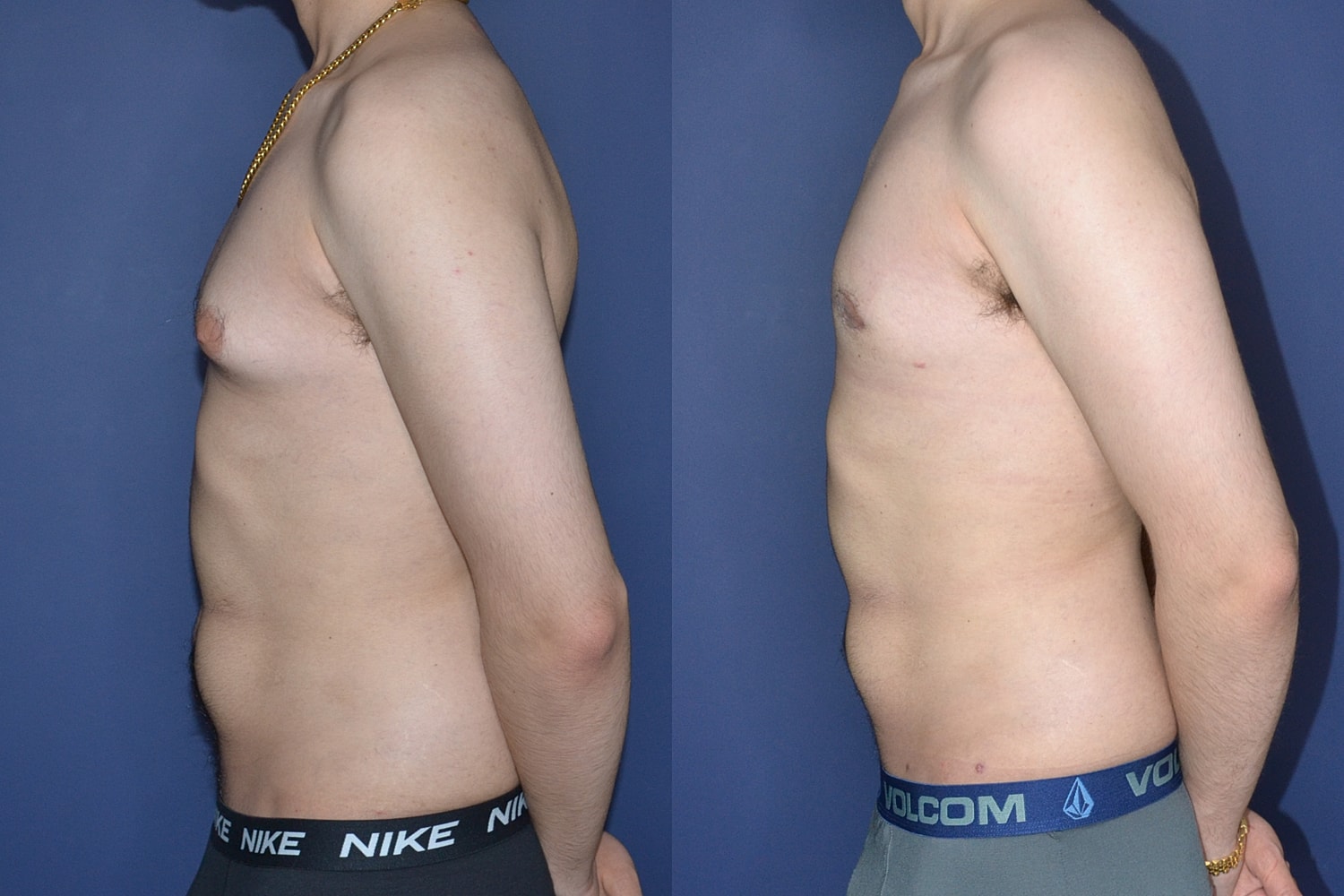 Side profile comparison of two individuals.